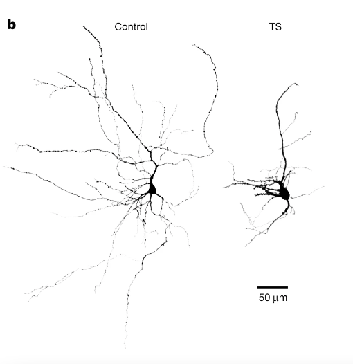 斯坦福大学7年研究登Nature：人鼠混合大脑成为现实！