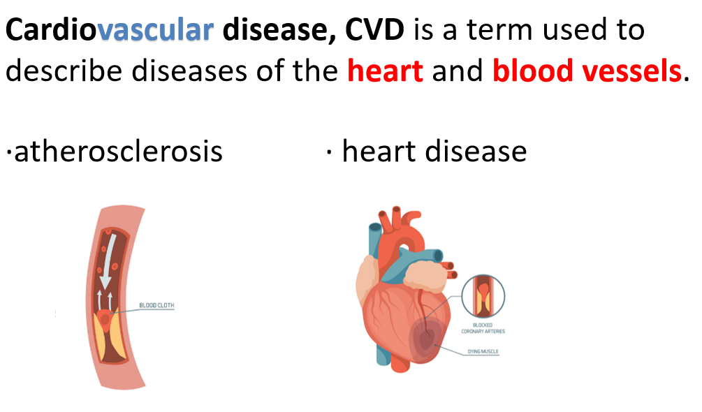 爱徳思生物Cardiovascular disease, CVD深度解析