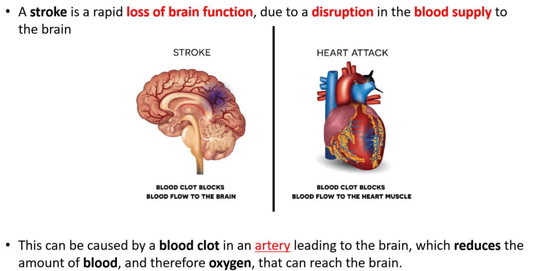 爱徳思生物Cardiovascular disease, CVD深度解析