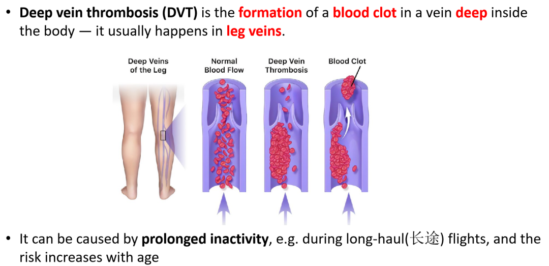 爱徳思生物Cardiovascular disease, CVD深度解析