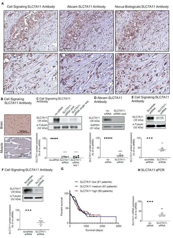 MIT科学家颠覆‘癌王’治疗难题！双靶点疗法有望让胰腺癌生存率翻倍