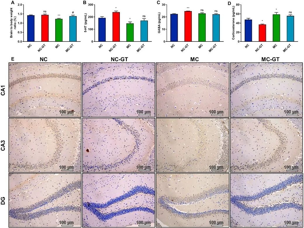 绿茶竟能抗抑郁？Phytotherapy Research：长期喝绿茶能有效改善抑郁样行为和认知功能，关键是这一机制！