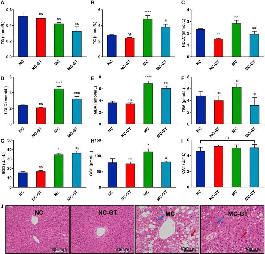 绿茶竟能抗抑郁？Phytotherapy Research：长期喝绿茶能有效改善抑郁样行为和认知功能，关键是这一机制！