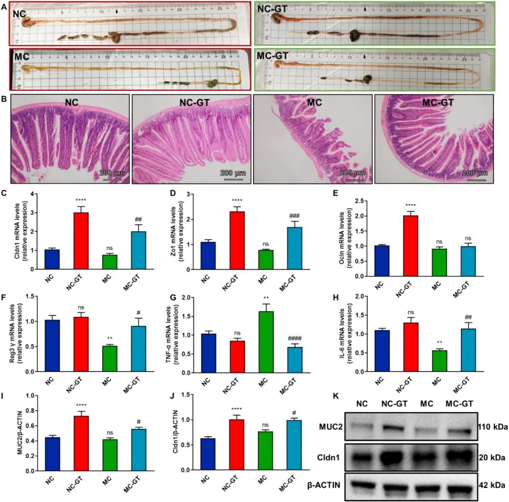 绿茶竟能抗抑郁？Phytotherapy Research：长期喝绿茶能有效改善抑郁样行为和认知功能，关键是这一机制！