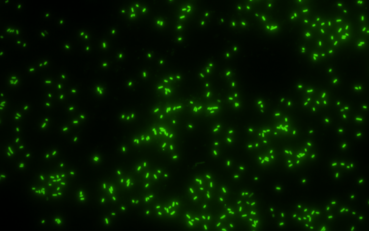 【生物化学科研】利用分子克隆技术用荧光蛋白将细菌进行标记,最后5个坑位! 【生物化学科研】利用分子克隆技术用荧光蛋白将细菌进行标记,最后5个坑位!