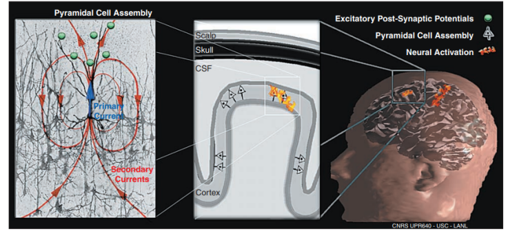 从深圳中学到牛津：EPQ脑机接口课题如何成为她的学术通行证