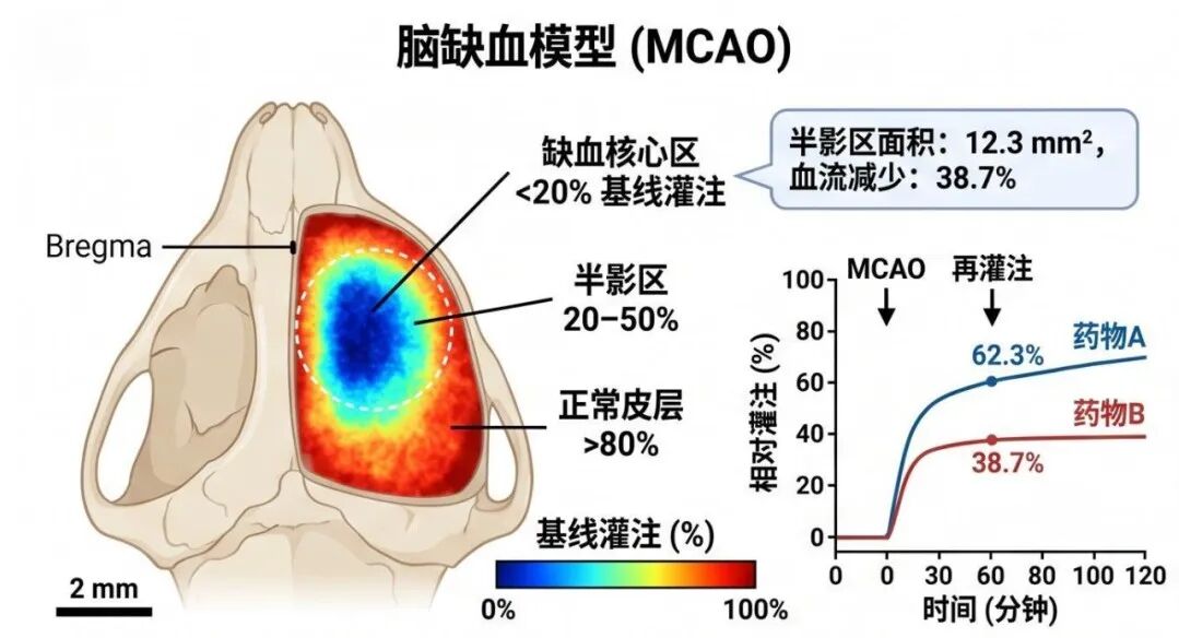 模型攻略 血流成像还在盲猜?一台激光散斑让缺血半暗带无处可藏