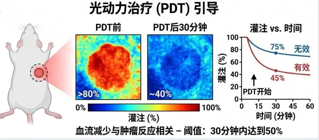 【模型攻略】血流成像还在“盲猜”？一台激光散斑，让缺血半暗带“无处可藏”