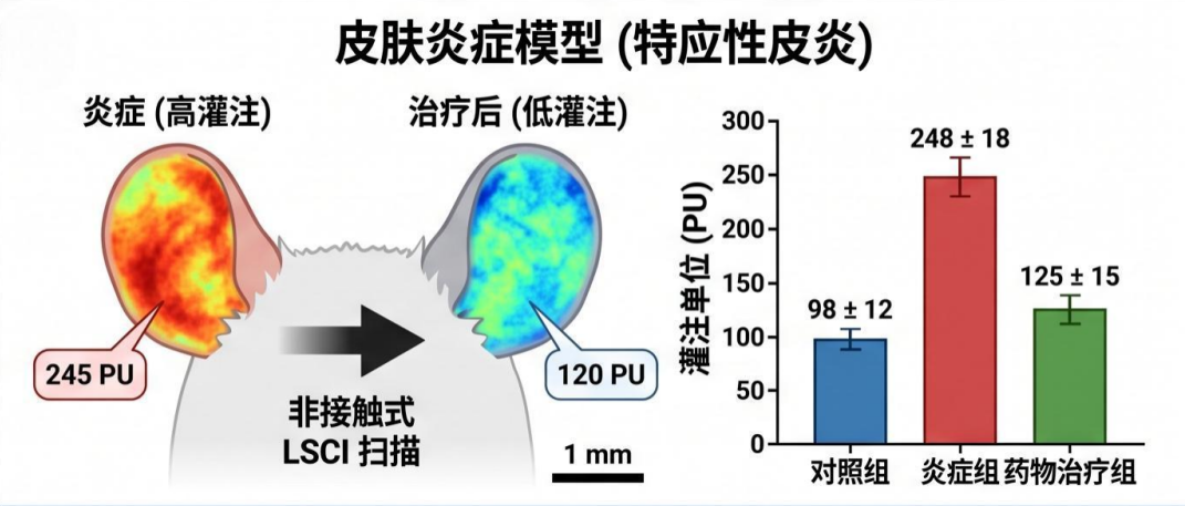 【模型攻略】血流成像还在“盲猜”？一台激光散斑，让缺血半暗带“无处可藏”