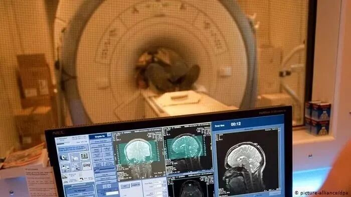 CT和MRI CT和MRI