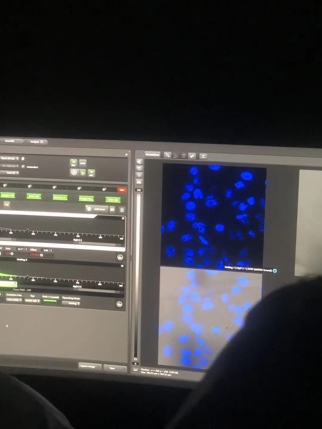 项目反馈 | 多肽的化学合成与生物活性研究 项目反馈 | 多肽的化学合成与生物活性研究